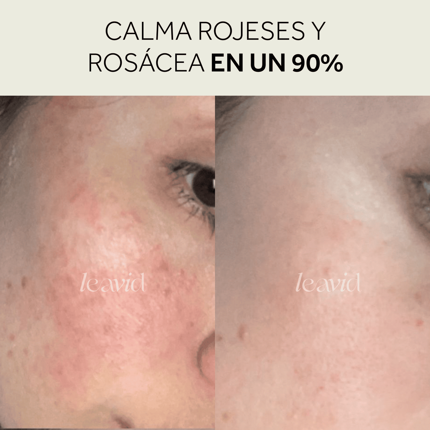 Kit Serum + Limpiador = Rutina Perfecta