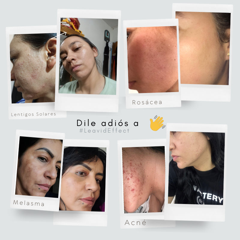 Serum Facial Aclarante e Hidratante