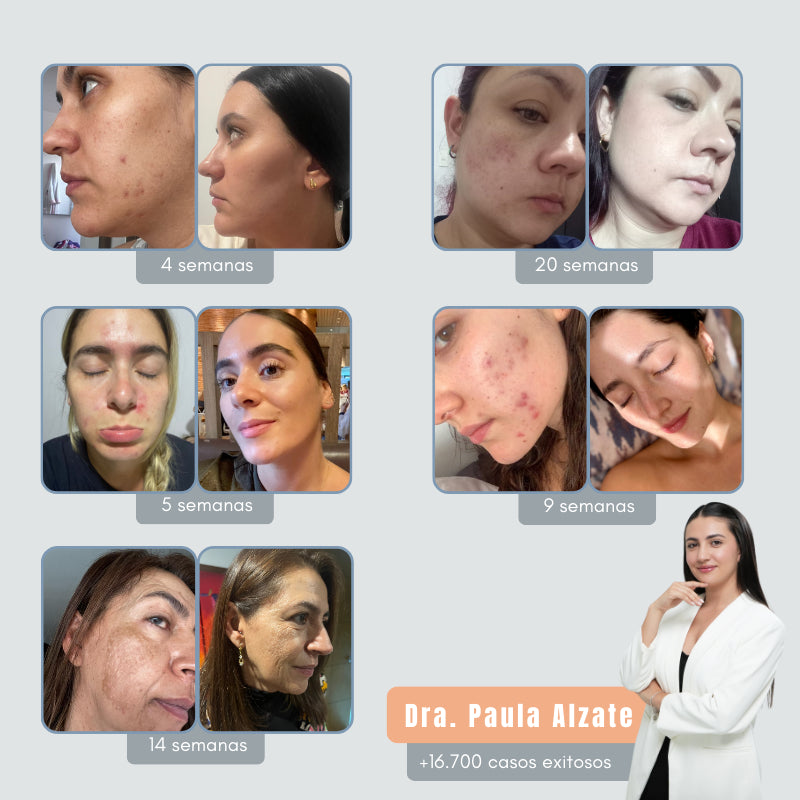Serum Facial Aclarante e Hidratante