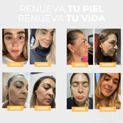 Serum Facial Aclarante e Hidratante