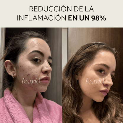 Kit Serum + Limpiador = Rutina Perfecta