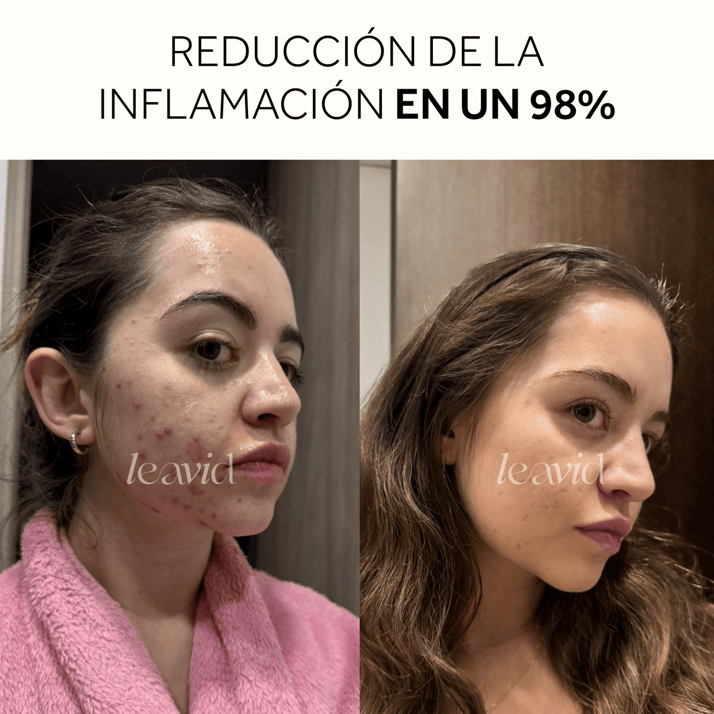 Serum Facial Aclarante e Hidratante