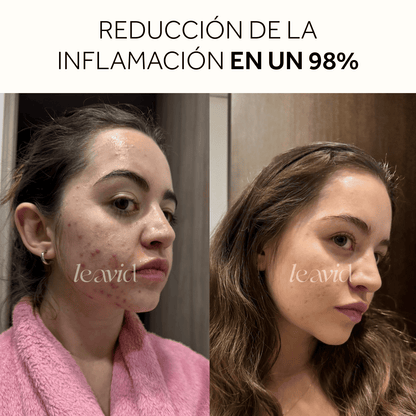 Serum Facial Aclarante e Hidratante