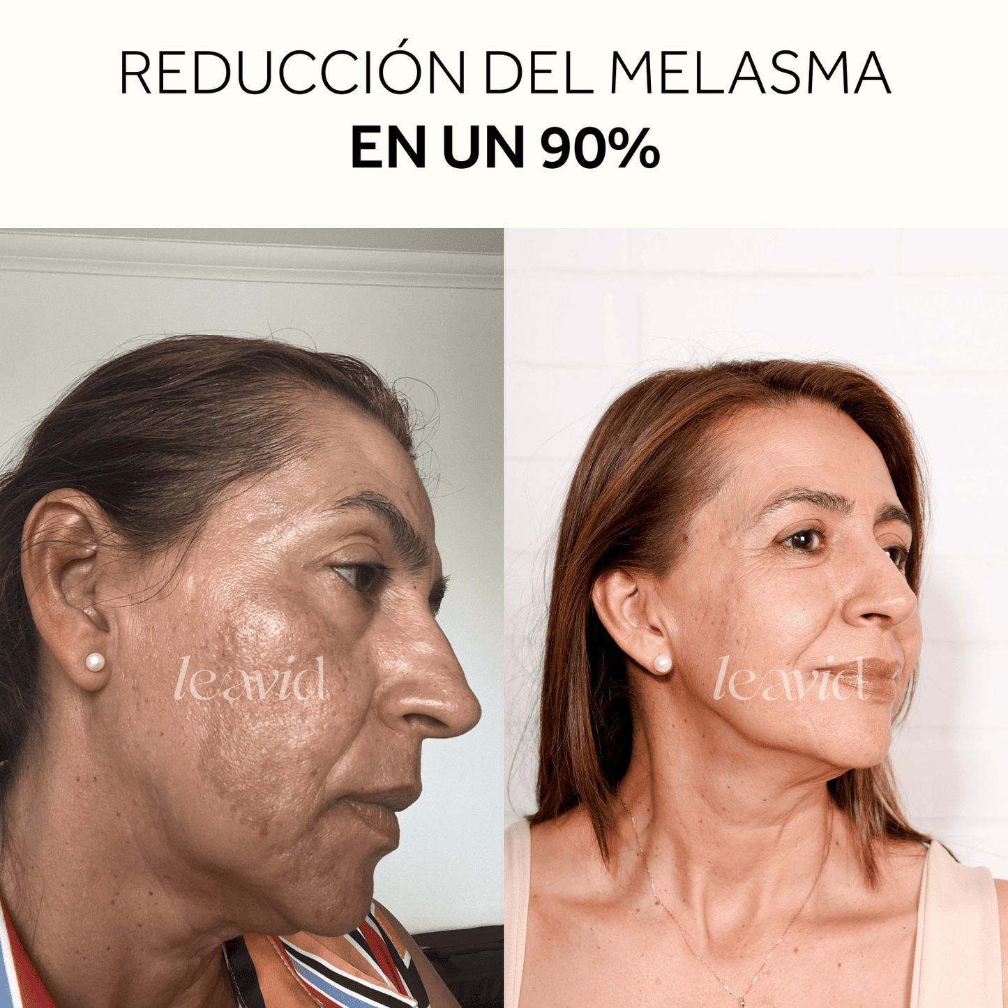 Serum Facial Aclarante e Hidratante