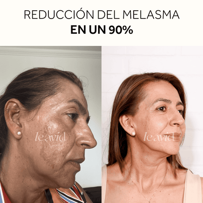 Serum Facial Aclarante e Hidratante