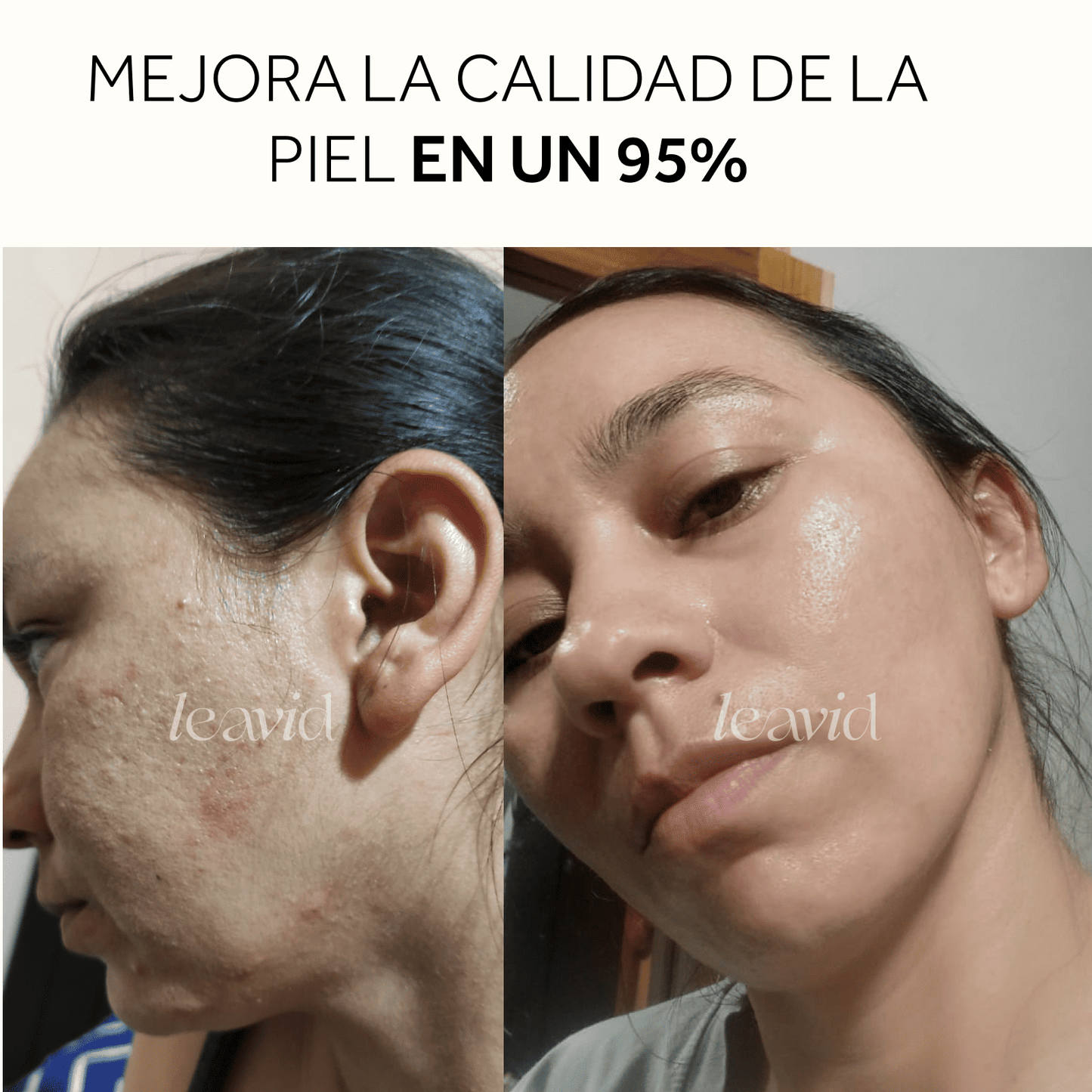 Serum Facial Aclarante e Hidratante