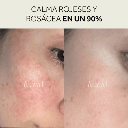 Kit Serum + Limpiador = Rutina Perfecta
