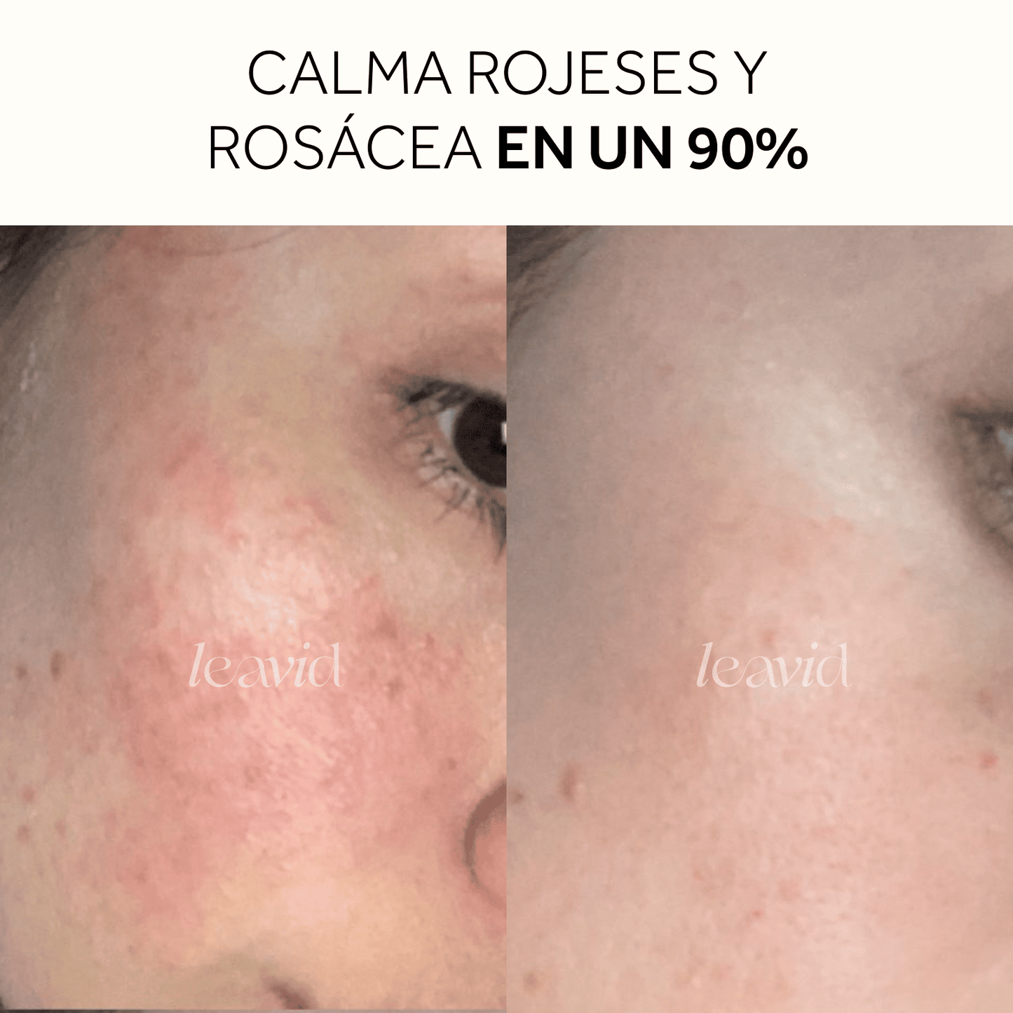 Serum Facial Aclarante e Hidratante