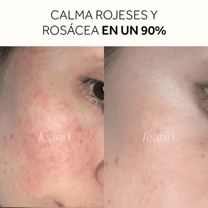 Serum Facial Aclarante e Hidratante