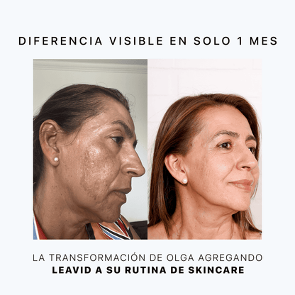 Serum Facial Aclarante e Hidratante